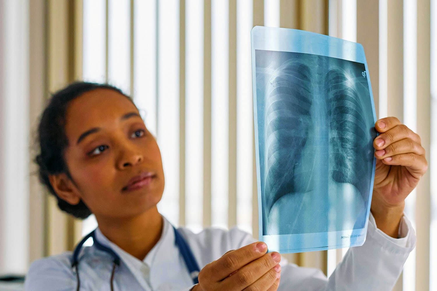 Thuis longfunctie meten verbetert behandeling systemische sclerose